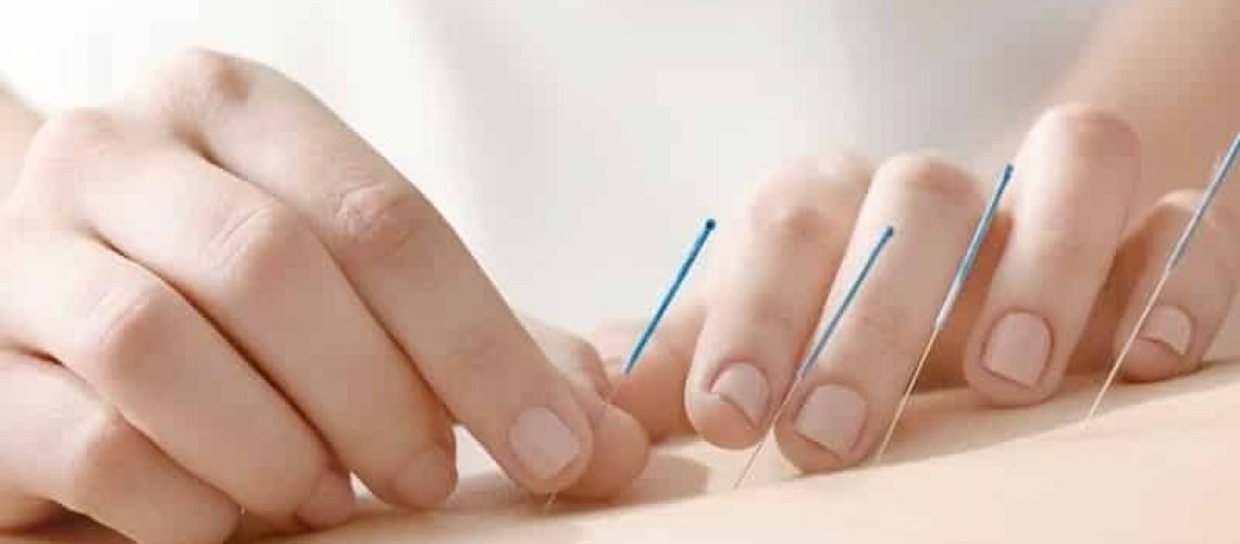 como-a-acupuntura-ajuda-a-combater-a-ansiedade-20181026145912